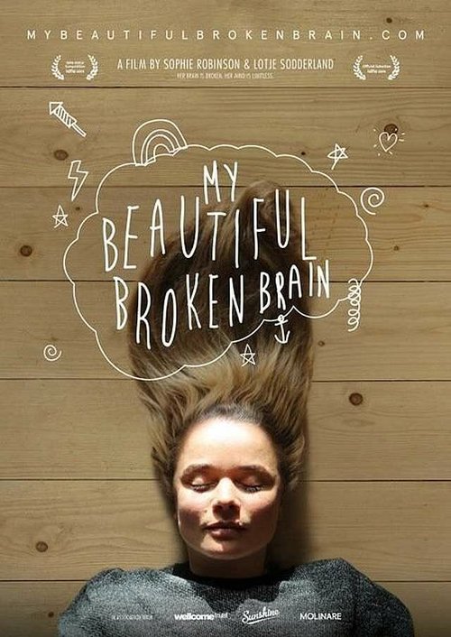 Смотреть фильм Мой прекрасный сломанный мозг / My Beautiful Broken Brain (2014) онлайн в хорошем качестве HDRip