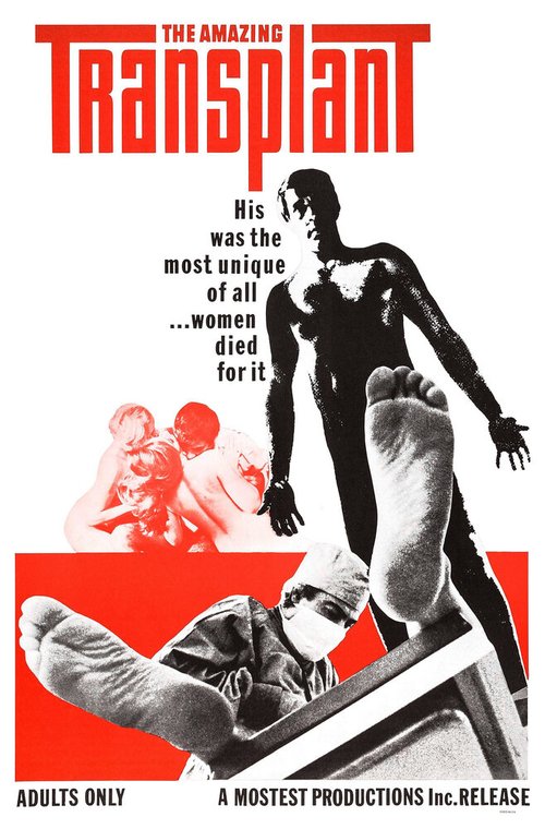 Смотреть фильм The Amazing Transplant (1970) онлайн в хорошем качестве SATRip