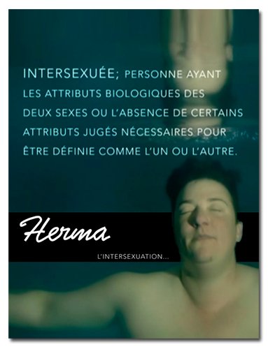 Герма. Интерсексуальность / Herma, xxy intersex