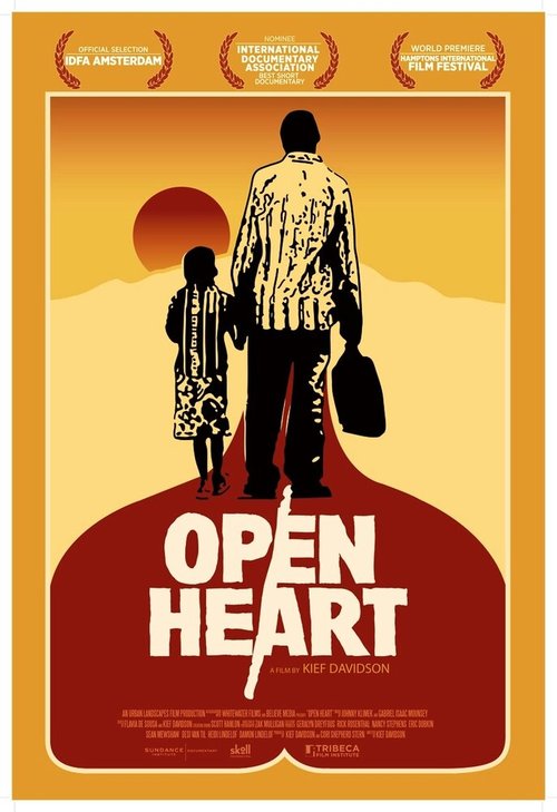Смотреть фильм Открытое сердце / Open Heart (2013) онлайн в хорошем качестве HDRip
