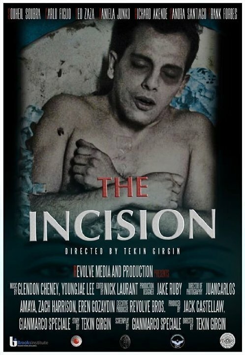Смотреть фильм The Incision (2014) онлайн 