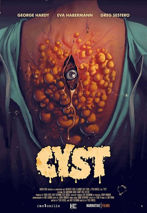 Смотреть фильм Киста / Cyst (2020) онлайн в хорошем качестве HDRip